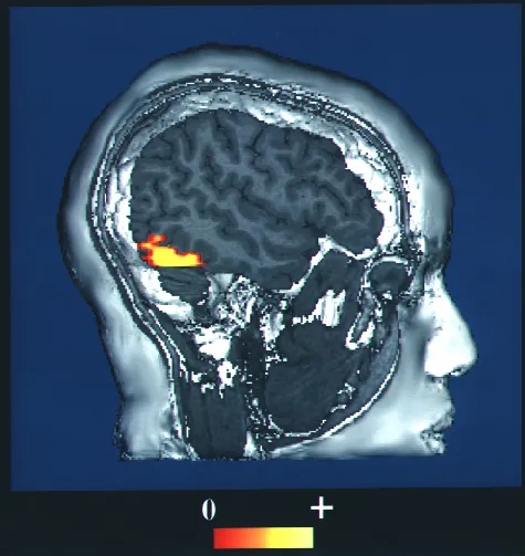 computer-enhanced fMRI scan