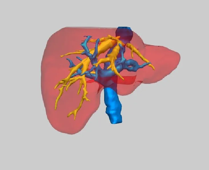 LIVER LESION SEGMENTATION