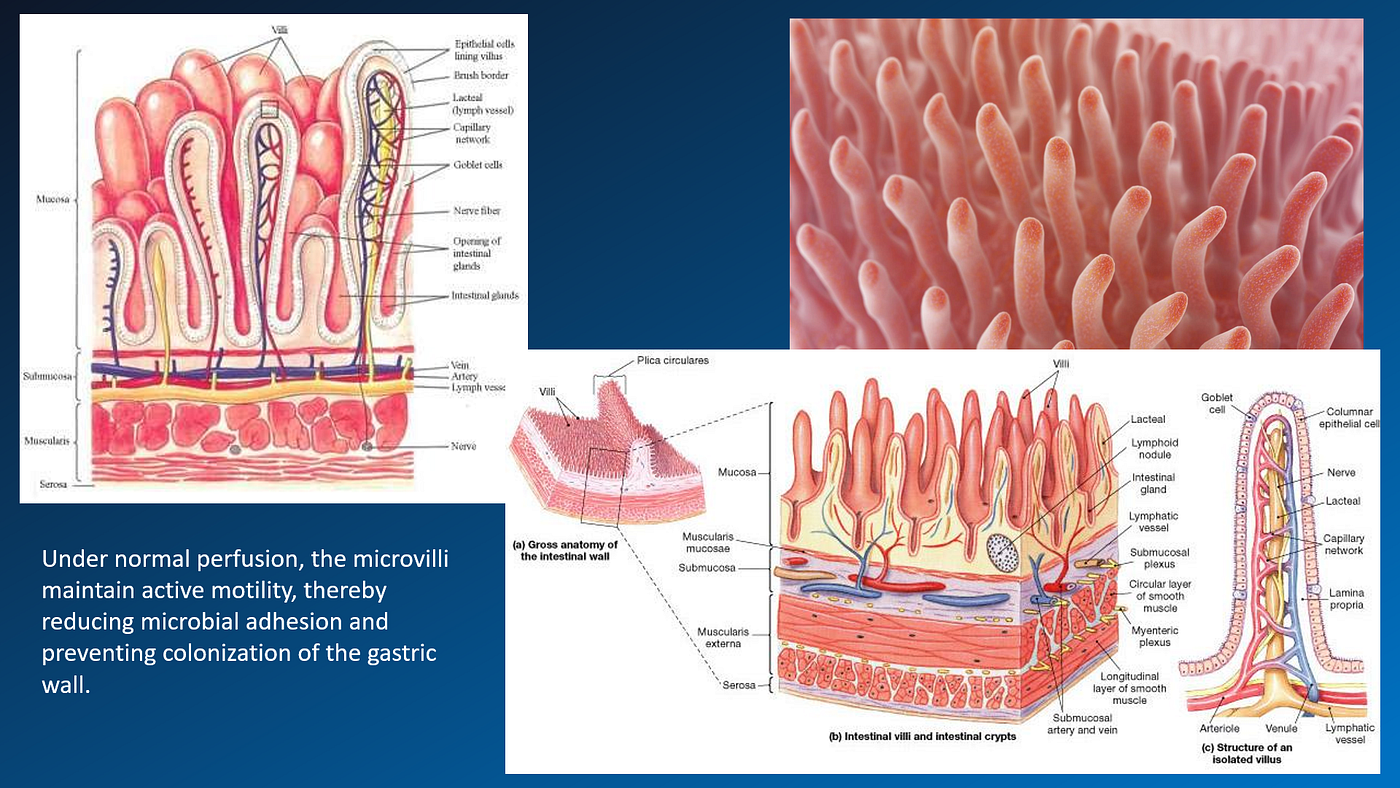 The Biggest Blind Spot in Medicine (2):You Thought Peptic Ulcers Were Caused by Excess Acid?