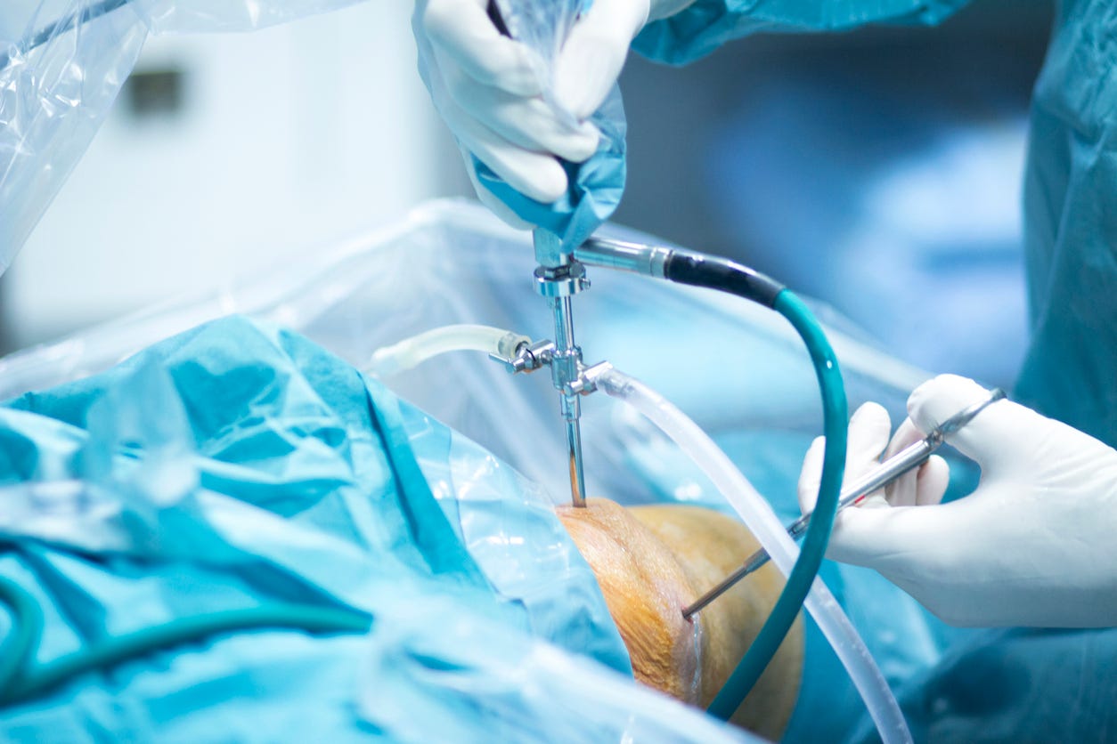 Ameliyata Giderken Yanımıza Ne Almalıyız? | by İçerik Pazarı | Jul, 2023 |  Medium