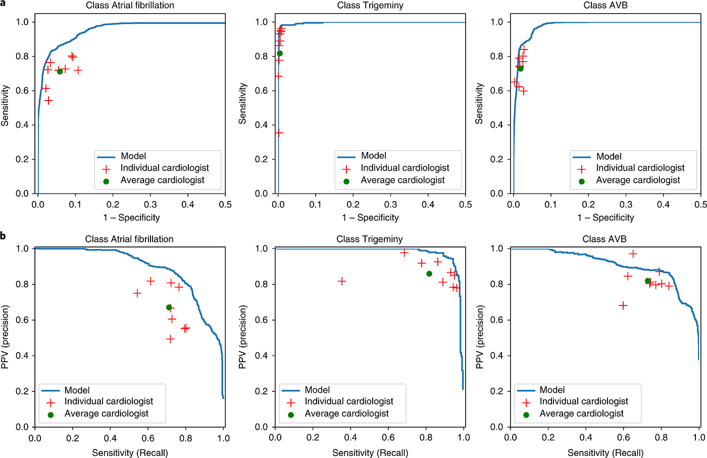 Cardiologist-level arrhythmia detection from raw single-lead ECG — a structured, explained summary