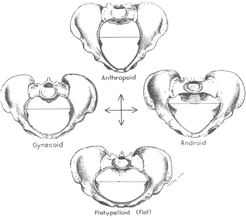 Gynaecoid Pelvis Practical Advice : Pelvic Pain In Pregnancy — Body