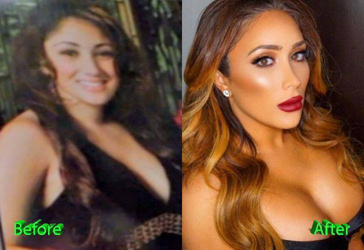 Nikki Mudarris Plastic Surgery Transformation Path | by Plastic Surgery |  Medium