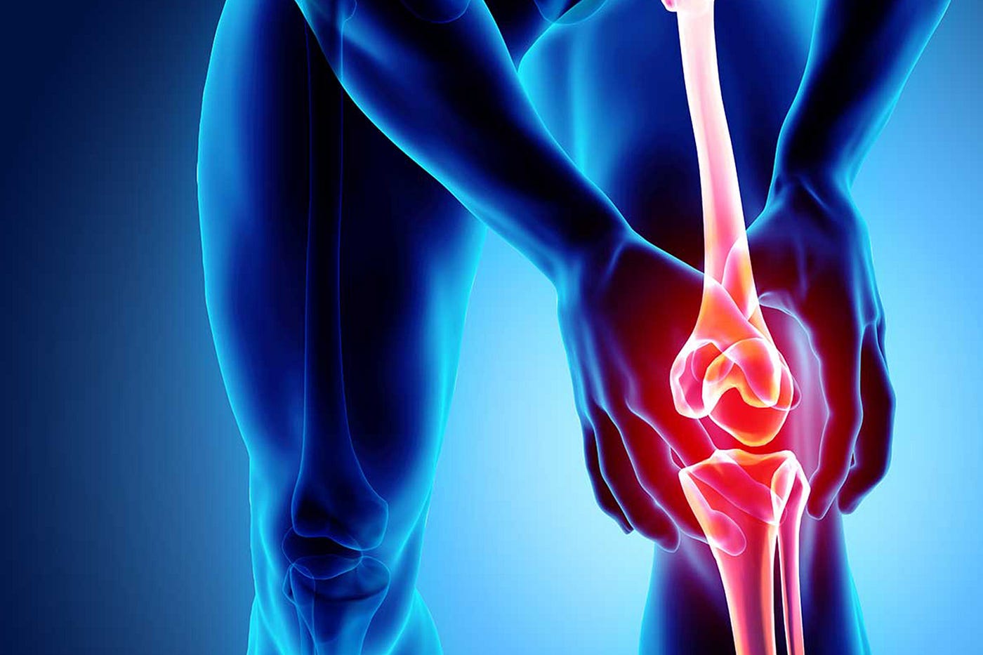 Should People With Knee Pain Check Their Vitamin D Levels? Insights From a Recent Study