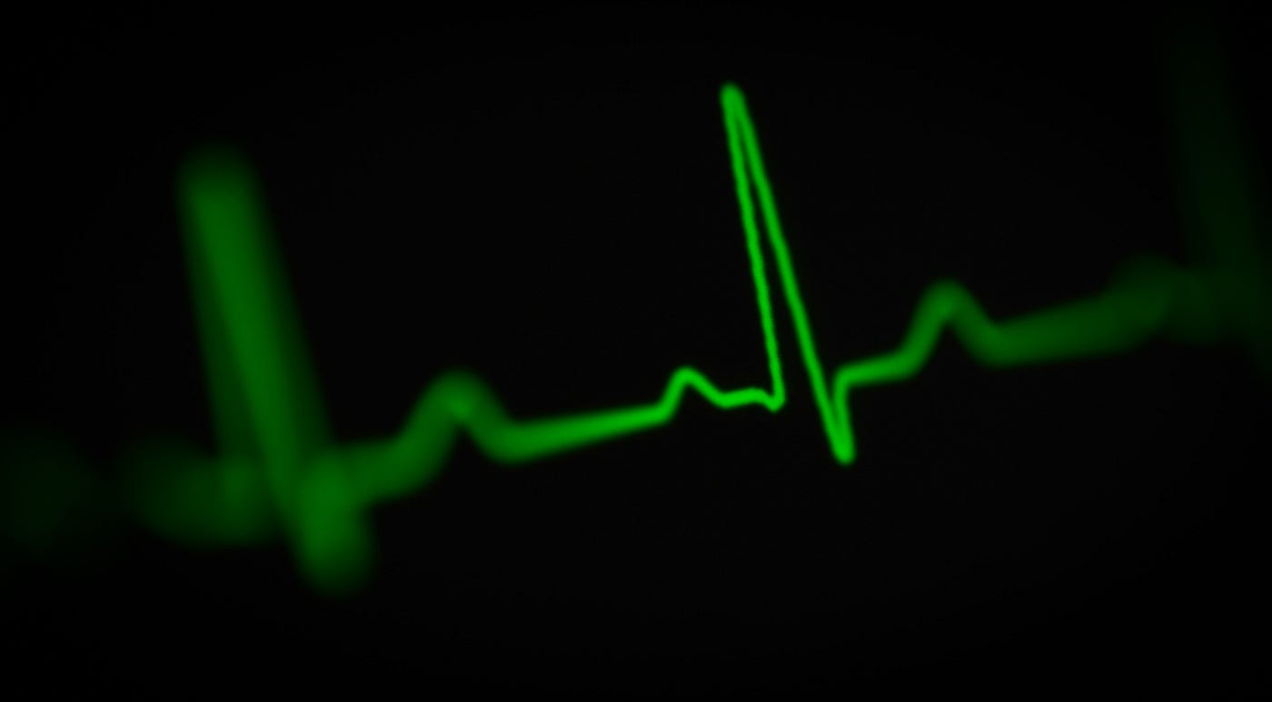 An EKG tracks many measures, including heart rate.