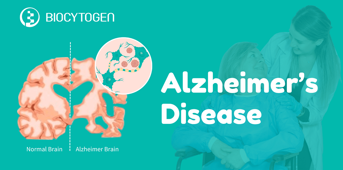 Breaking New Ground in Alzheimer’s Treatment: A Deep Dive into Lilly’s Kisunla™ (Donanemab-azbt)…