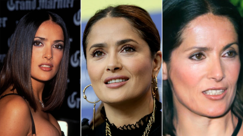 A PLASTIC SURGEON REVEALS WHAT FAMOUS WOMEN WOULD LOOK LIKE IF THEY DIDN'T  DO SURGERY | by Viral Storm | Medium