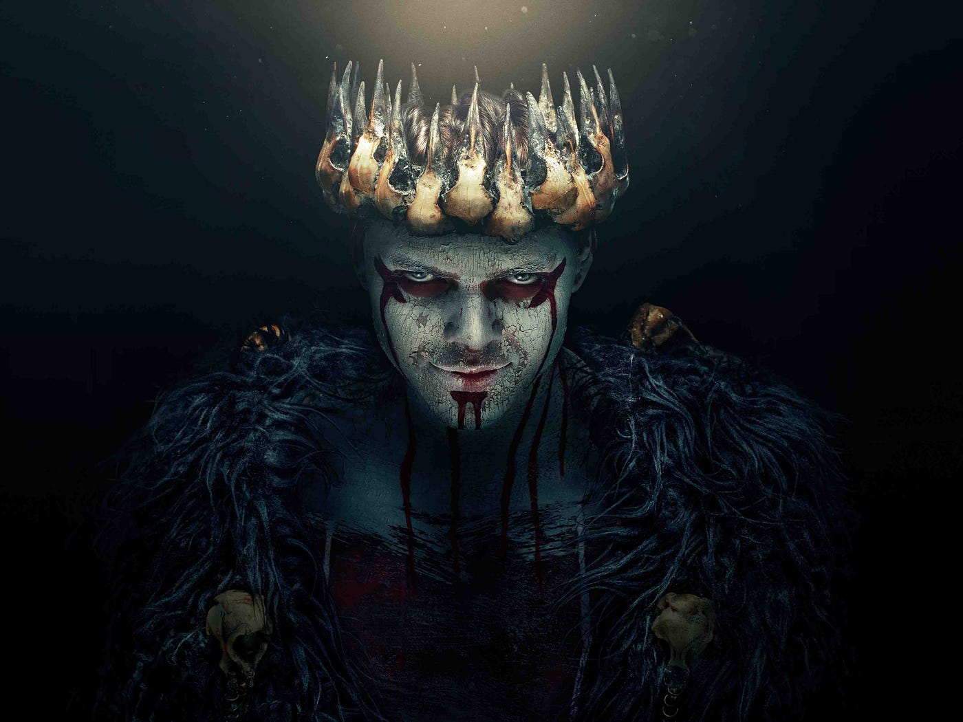 My life was filled with Anger - Ivar the boneless, Ivar