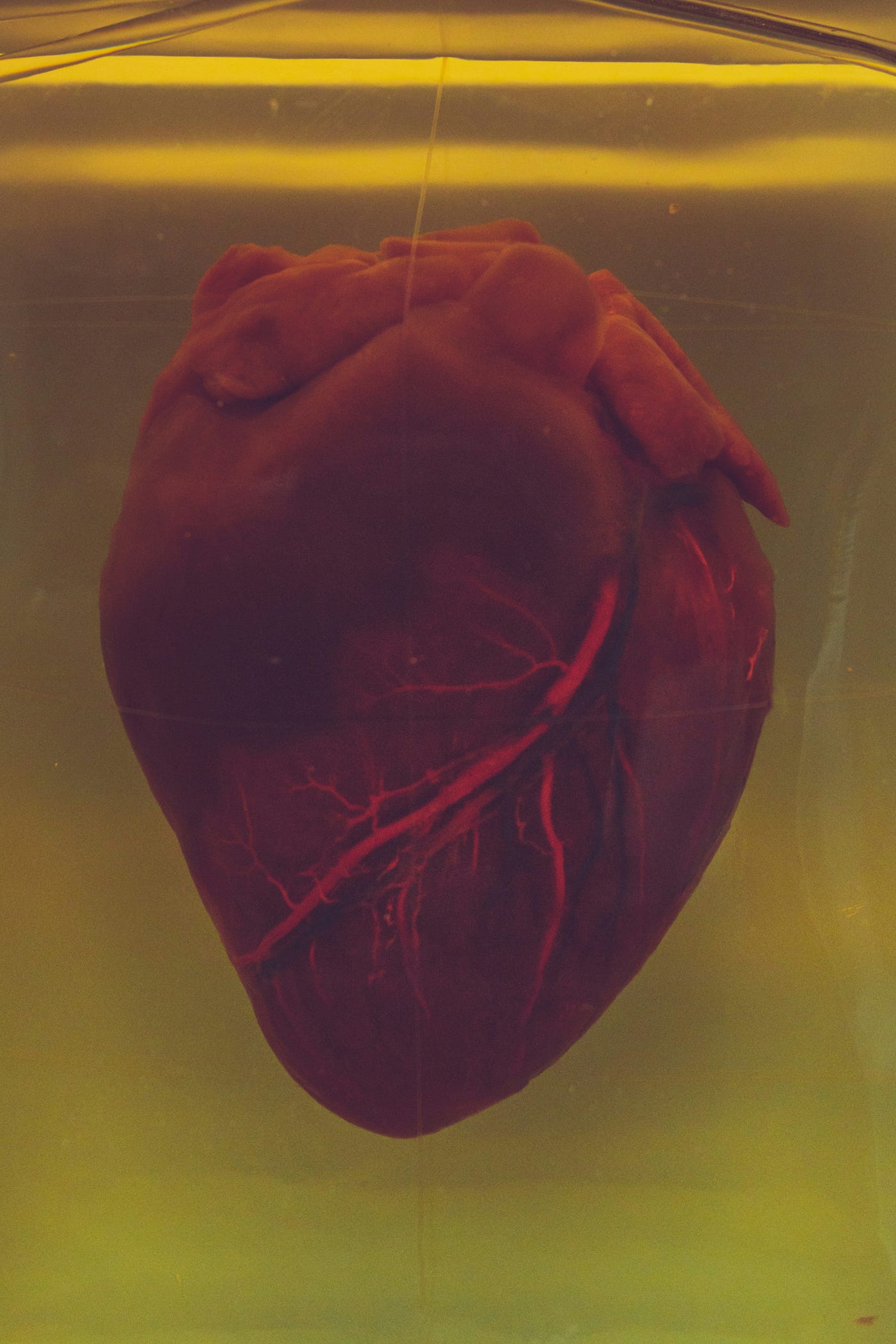 An anatomic representation of a human heart. The Atlantic diet is heart-healthy.