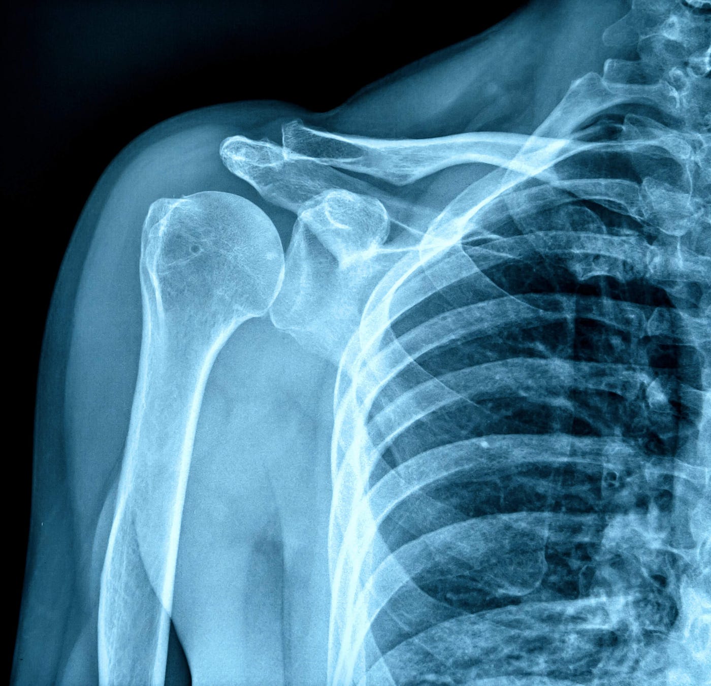 X-ray Image