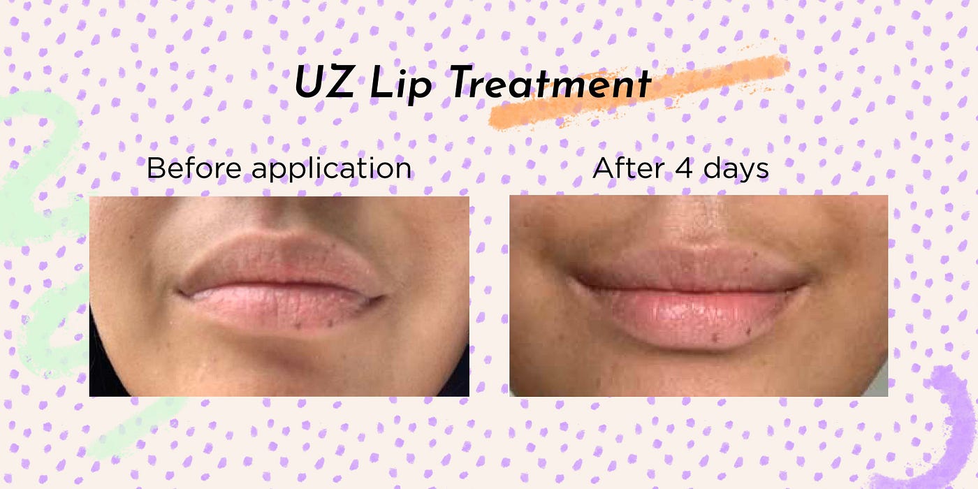 uz 38 c/99 f lip treatment Carnipure L-Carnitine - Supports Fat Metabolism & Muscle Recovery -  Raspberry (16 fl. oz.) main image 0