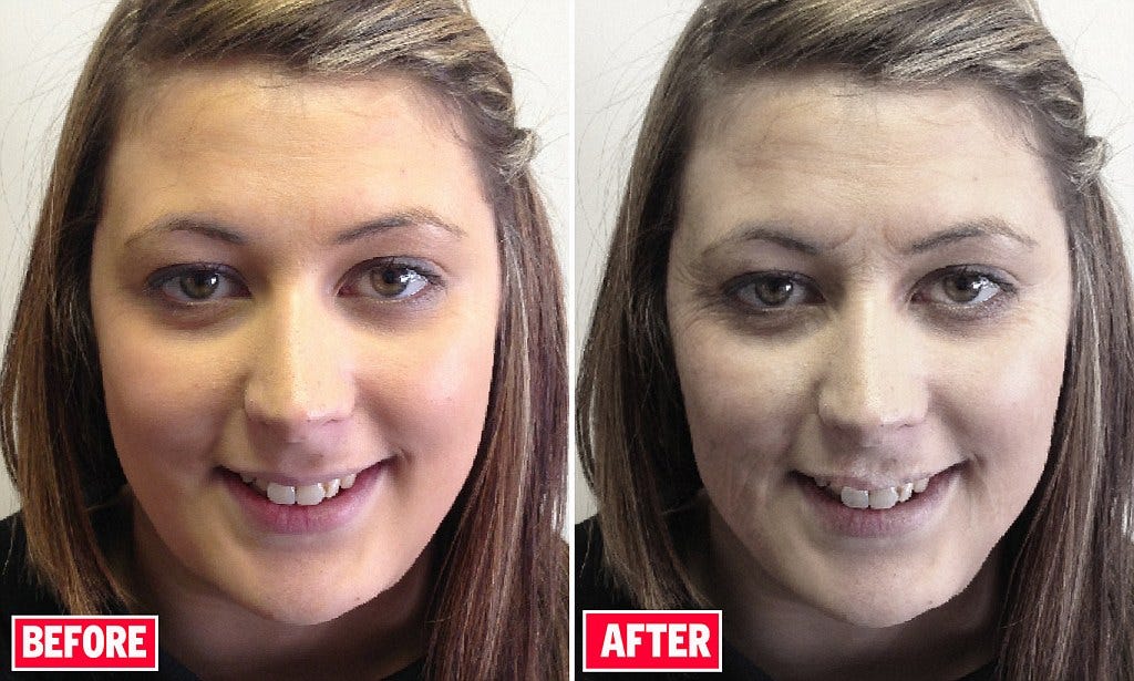 tobacco smokers before and after What Happens to Your Body When You Stop Smoking within the First 8 Hours? |  by 1