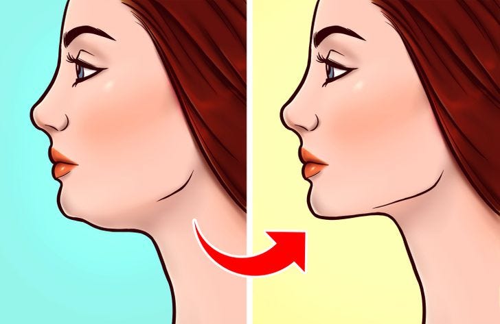 Improve Facial Structure with Correct Tongue Posture