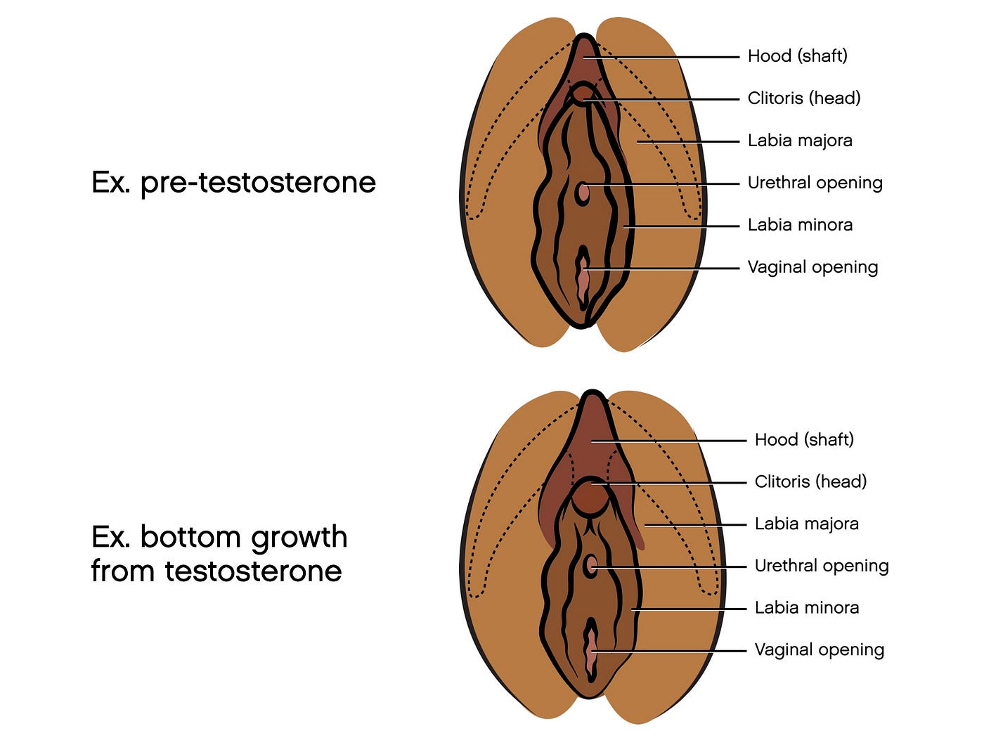 Transman bottom growth