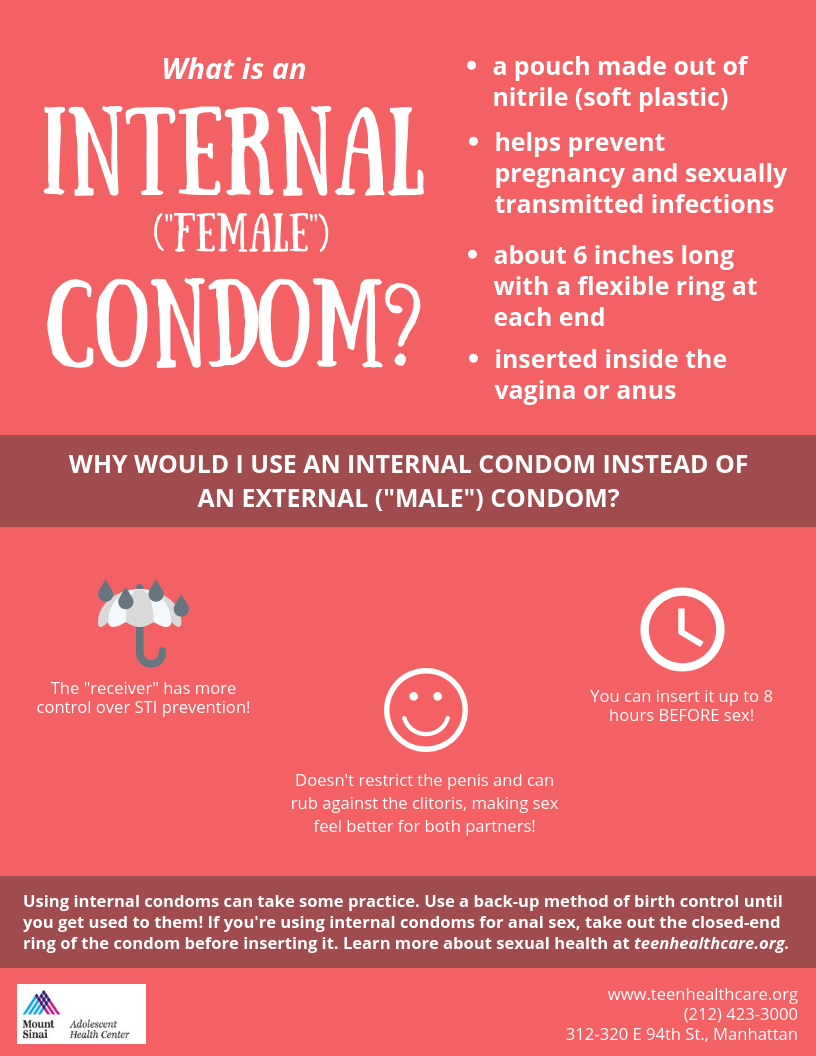 What is an Internal (“Female”) Condom? by Mount Sinai Adolescent Health Center Medium picture