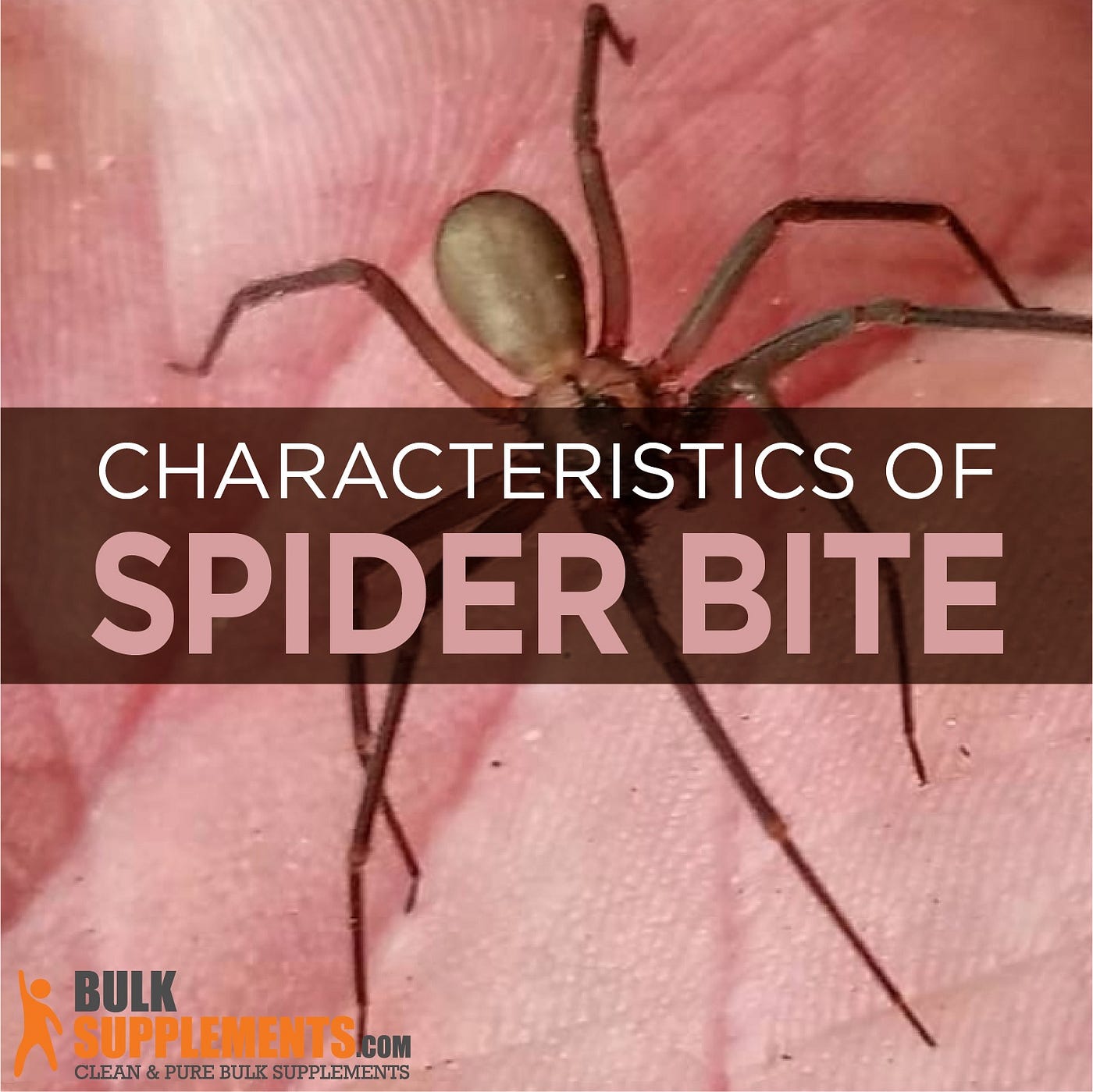 Spider Bite: Characteristics, Causes & Treatment