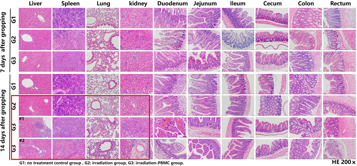 On day 7, G1 mice show no significant pathological changes, while G2 and G3 mice exhibit reductions in splenic lymphocyte counts due to radiation, with substantial monocyte and granulocyte presence in G3 spleens. By day 14, G1 and G2 mice continue to exhibit no significant pathology; however, G3 mice display increased splenic granulocytes/lymphocytes and mixed inflammatory cell infiltration in the liver, lungs, and kidneys. Additionally, scattered patchy necrosis is observed in these organs, along with congestion and bleeding in the duodenum and jejunum, and patchy bleeding and necrosis in the spleen.