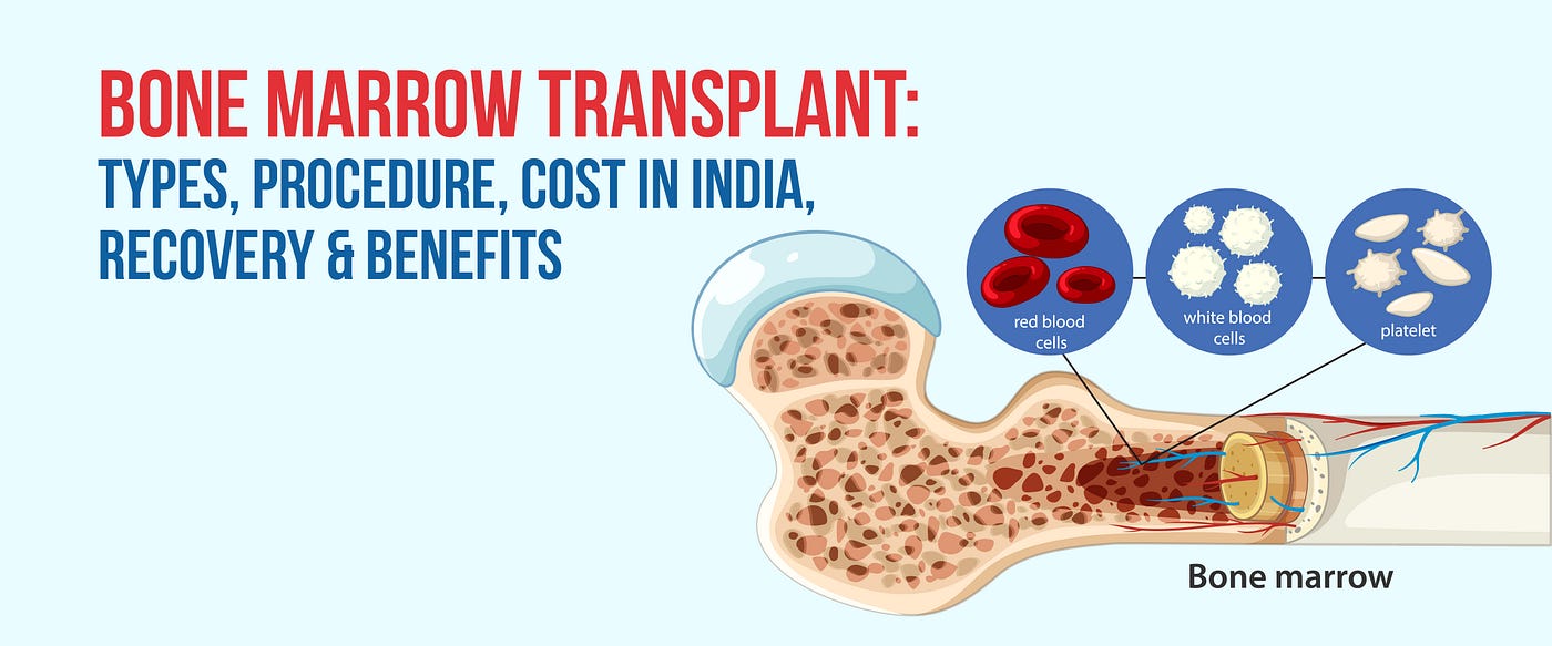 Bone Marrow Transplant: Types, Procedure, Cost in India, Recovery & Benefits