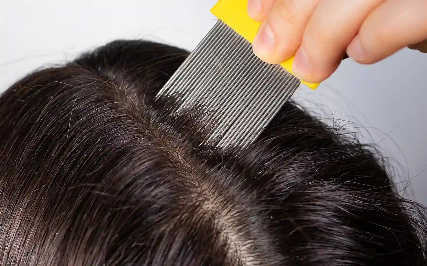 Does Hair Color Kill Nits and Lice — A Must-Know Guide for Everyone