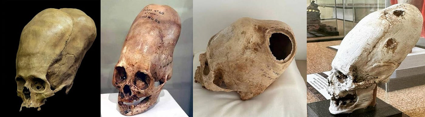 Elongated Skulls: The Forbidden Truth Hidden by Academic Science