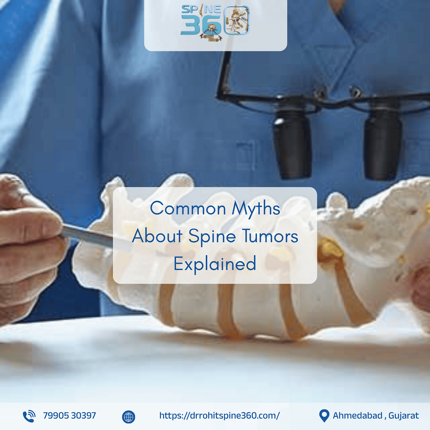 Common Myths About Spine Tumors Explained