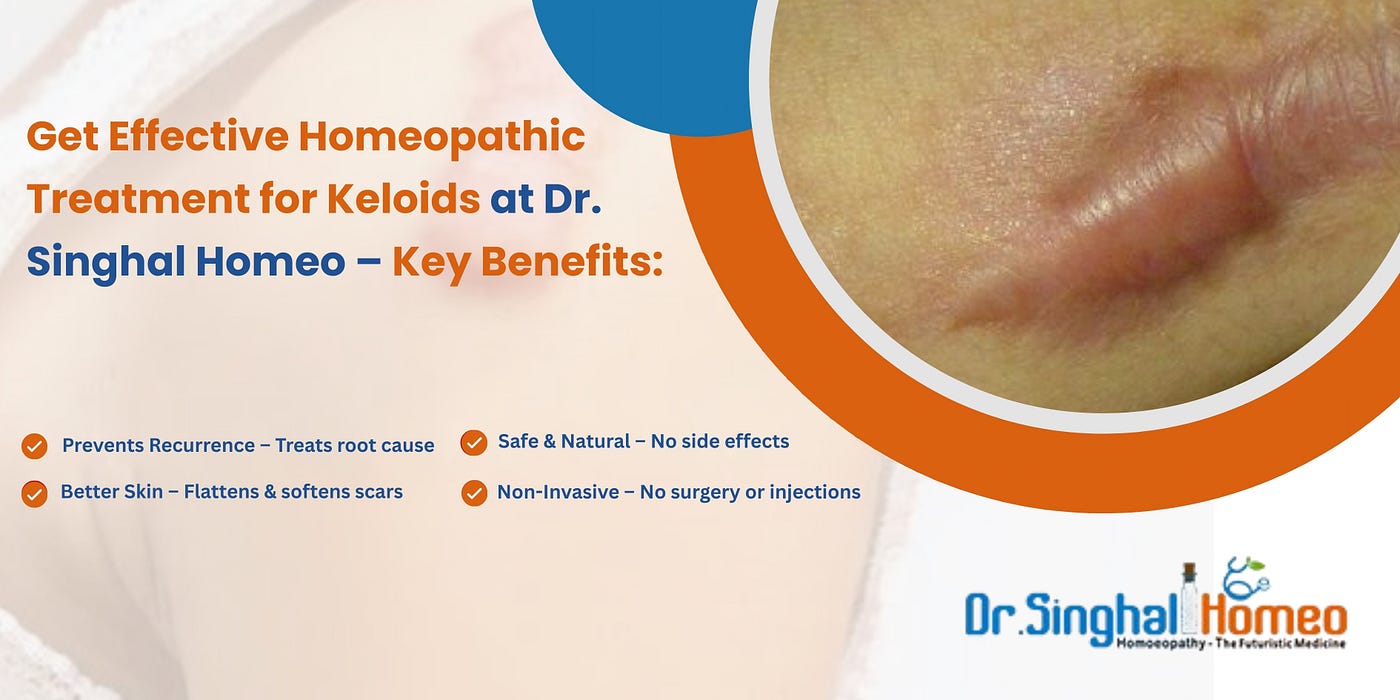 Homeopathic Approaches to Keloid Management: A Comprehensive Review of Treatment Options