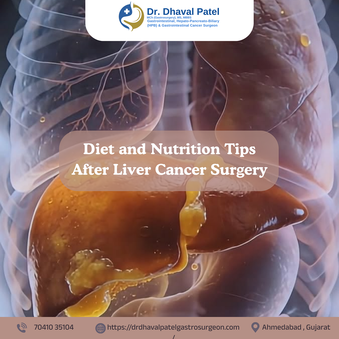 Diet and Nutrition Tips After Liver Cancer Surgery