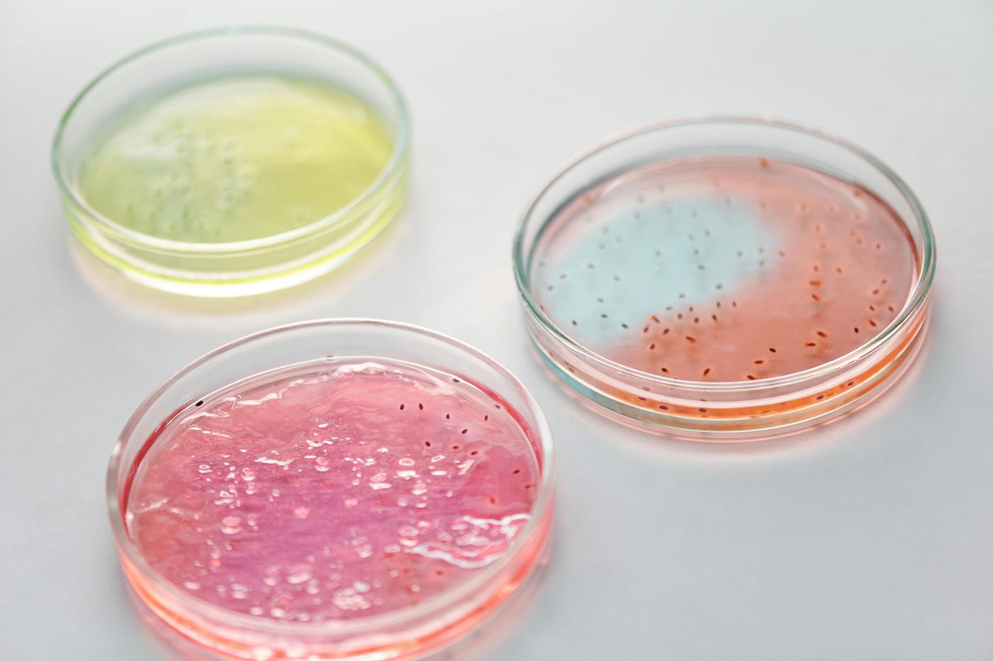 Vorsicht! Nicht verwechseln: Probiotika, Präbiotika, Postbiotika und Synbiotika im Fokus der…