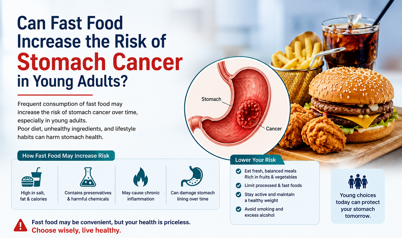 Can Fast Food Increase the Risk of Stomach Cancer in Young Adults?
