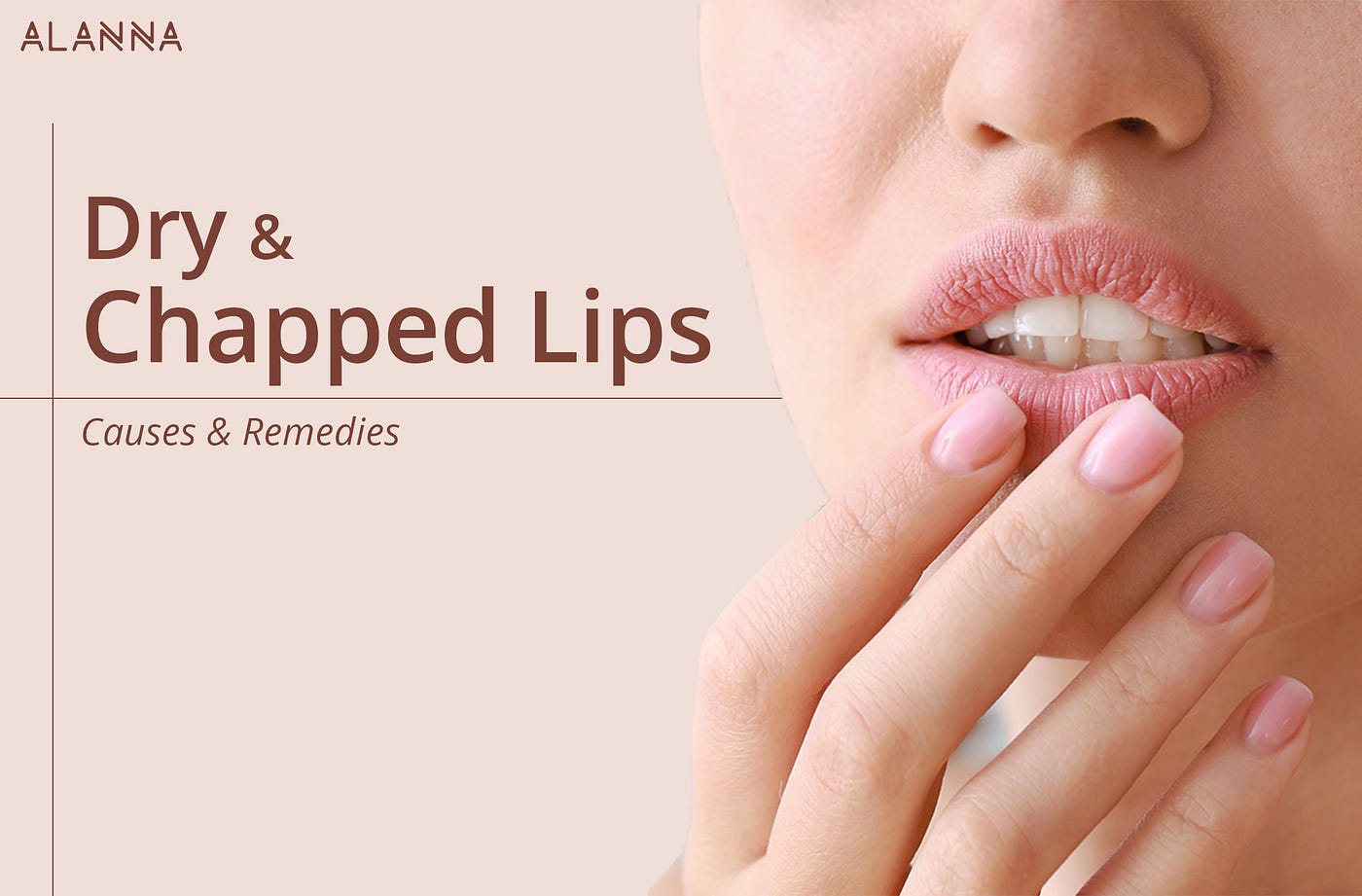 Dry & Chapped Lips : Causes & Remedies - ALANNA : India's First Specialised  Lip Care Brand - Medium