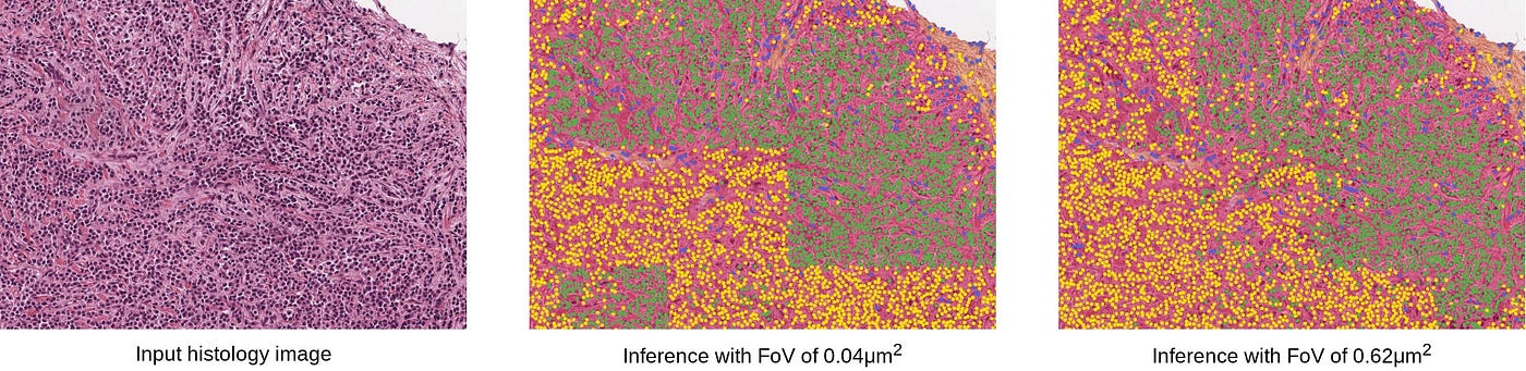 Artifacts created by running inference with a smaller field-of-view (FoV) can disappear simply by running inference with a larger window-size or FoV.