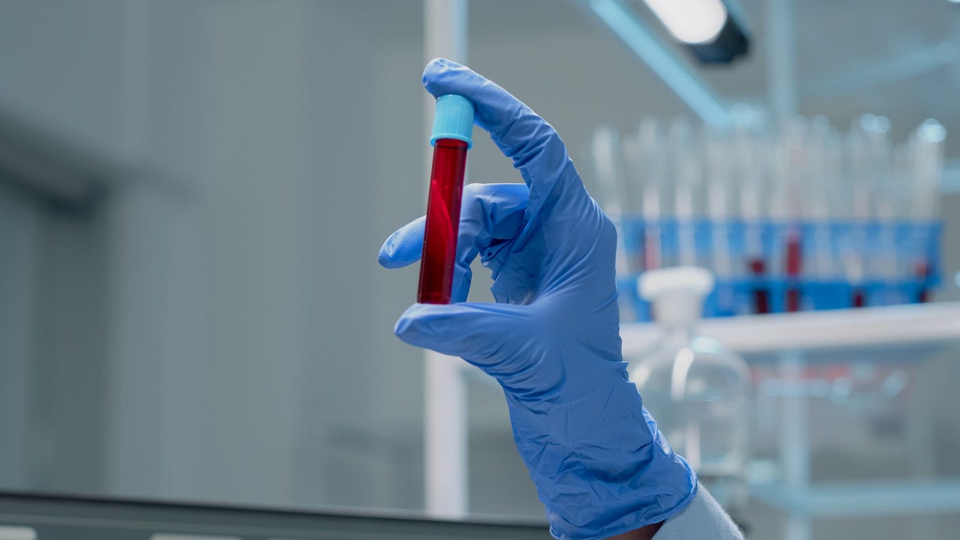 🩸🏠 Blood Sample Collection at Home in Ranchi
 Safe, hygienic aur trained professional ke saath…