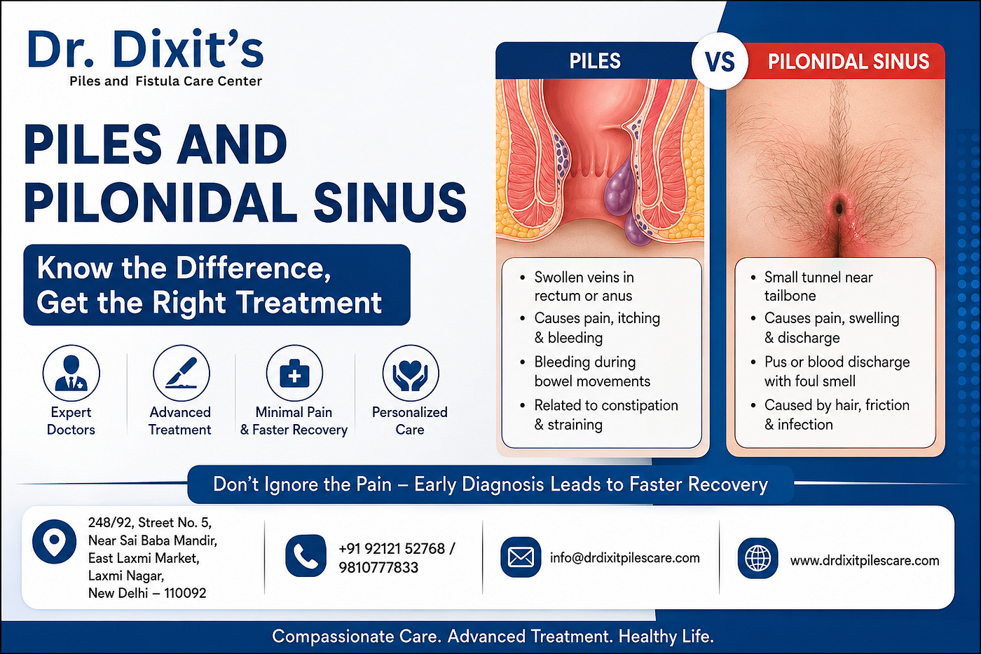 Piles and Pilonidal Sinus: Understanding the Difference, Symptoms, Causes and Treatment Options