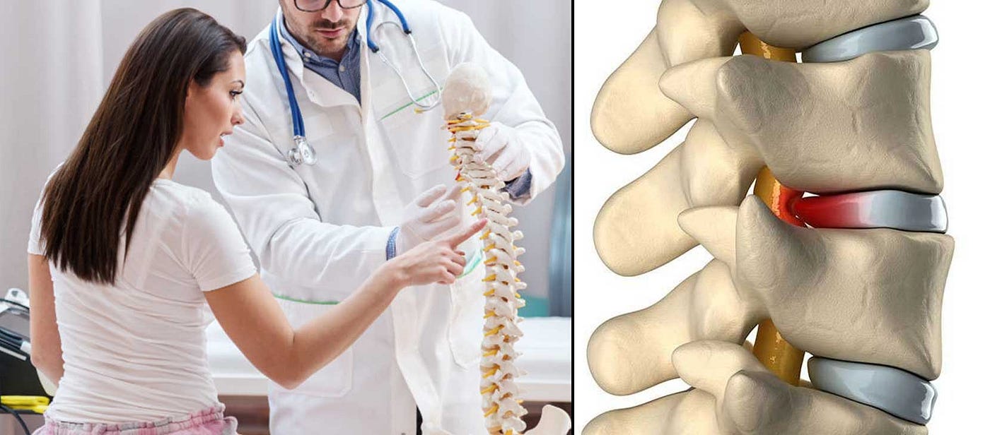 EEZ ALIGN — Spine Alignment Physiotherapist in Gurgaon