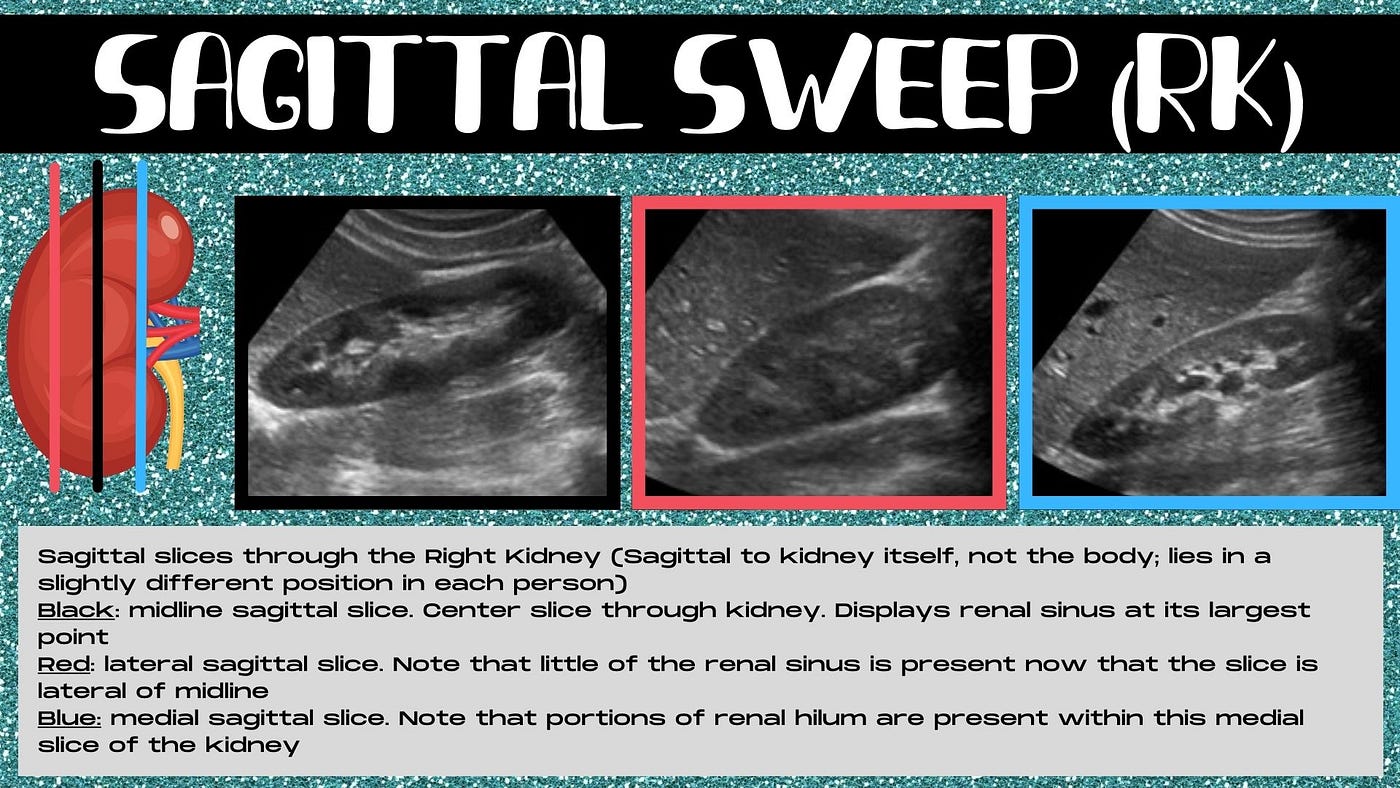 Can Ultrasound Techs Tell You Results: The Truth Unveiled