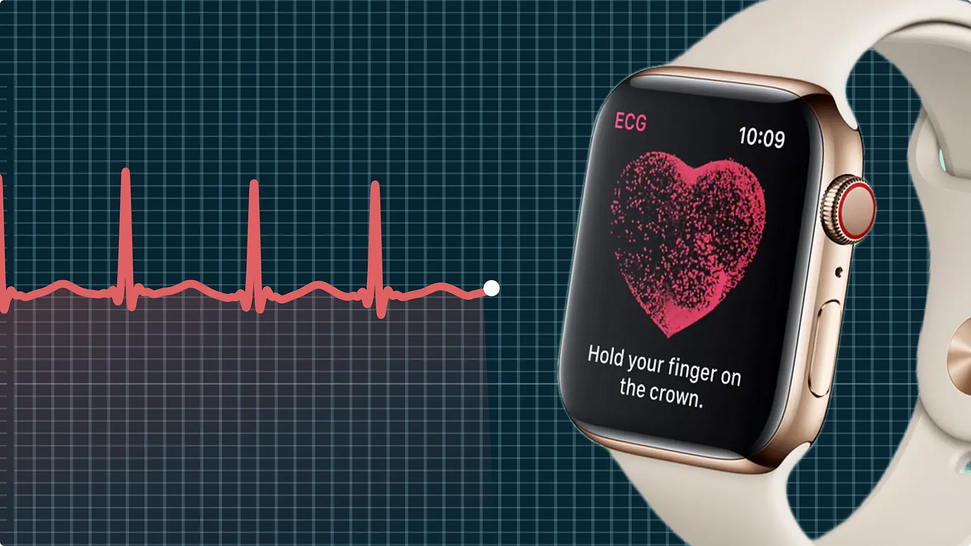 How to Record an ECG Using Your Apple Watch