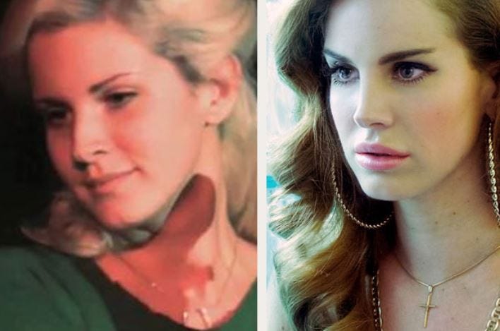 lana del rey before and after