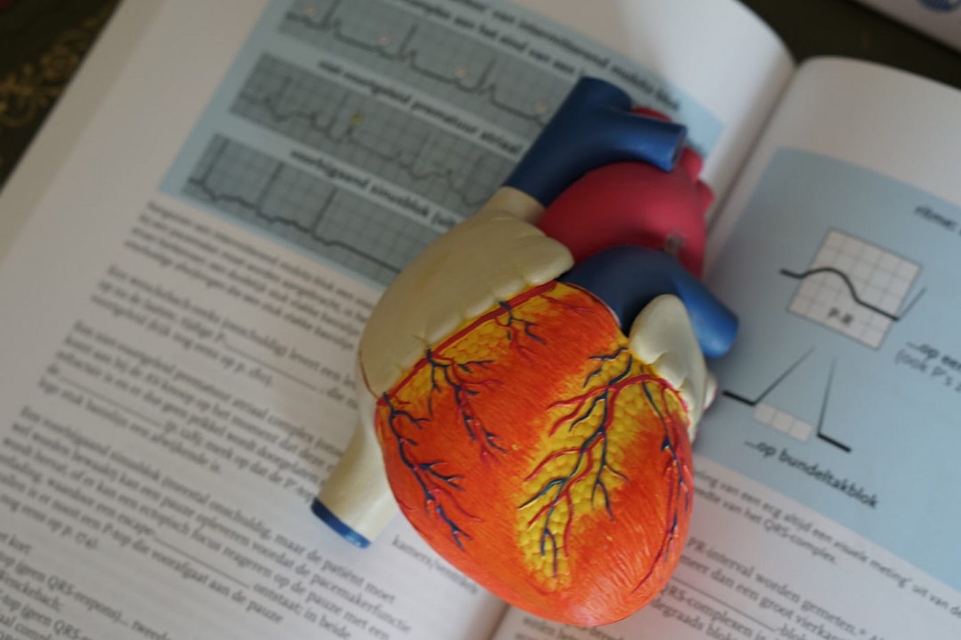 Heart Attack vs. Cardiac Arrest