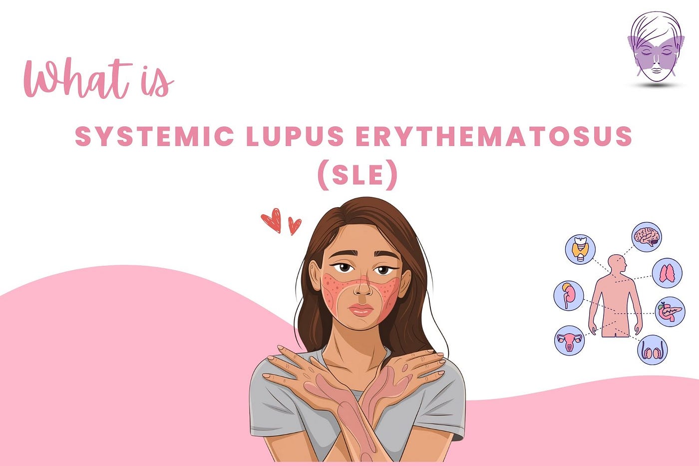 The Disease with a Thousand Faces: Decoding Lupus