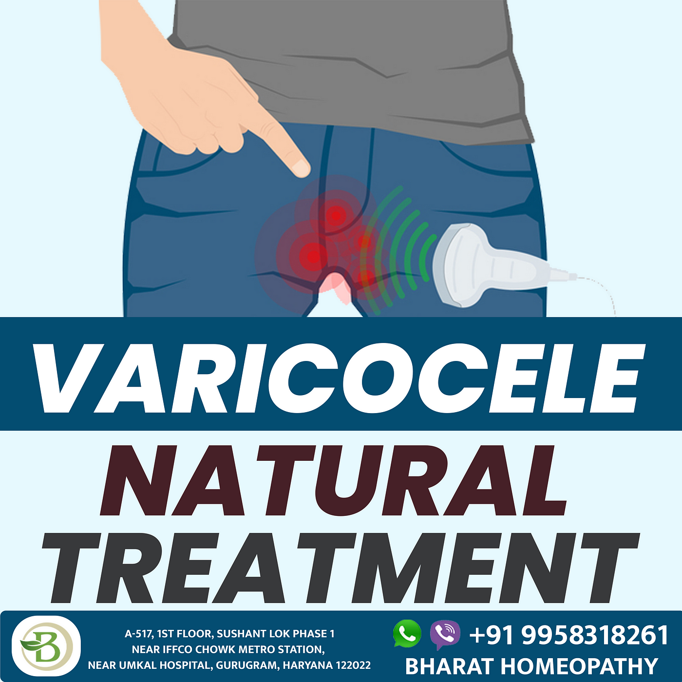 Effective Treatment Options for Varicocele: Exploring the Best Approaches, by bharat homeopathy