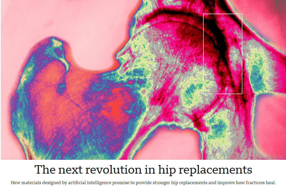 How AI is reshaping hip implants: A review of BBC research