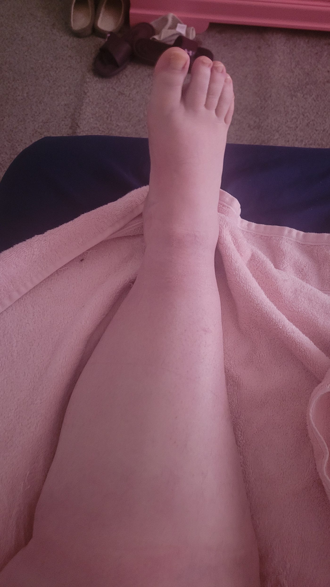 tirzepatide lymphedema Tirzepatide Is a Game Changer For Super Fat Patients Like Me | by Shannon  Ashley | Honestly Yours