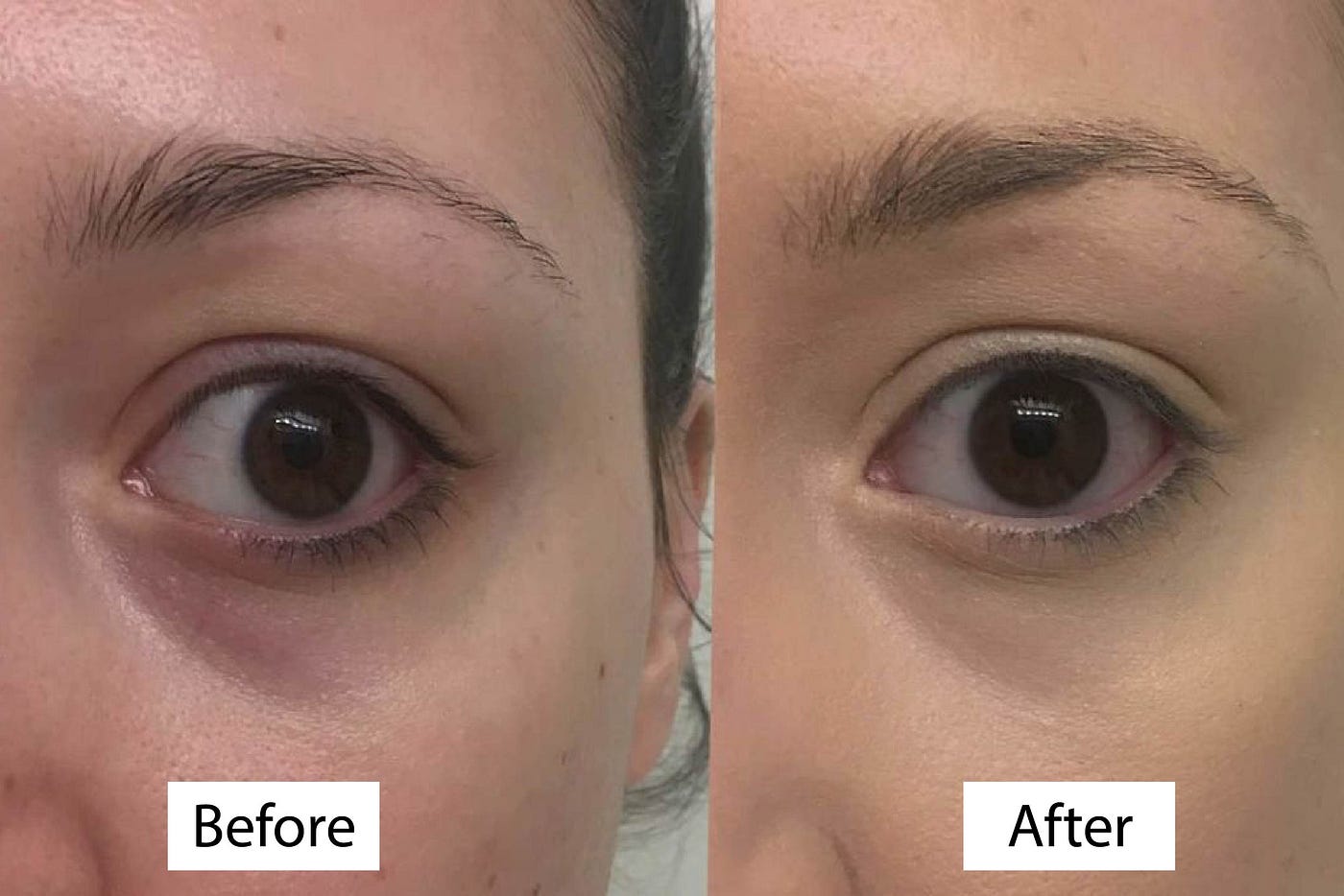 Unveiling the Transformation: Banana Bright Eye Cream Before and After | by  Beauty & Fashion | Jul, 2023 | Medium
