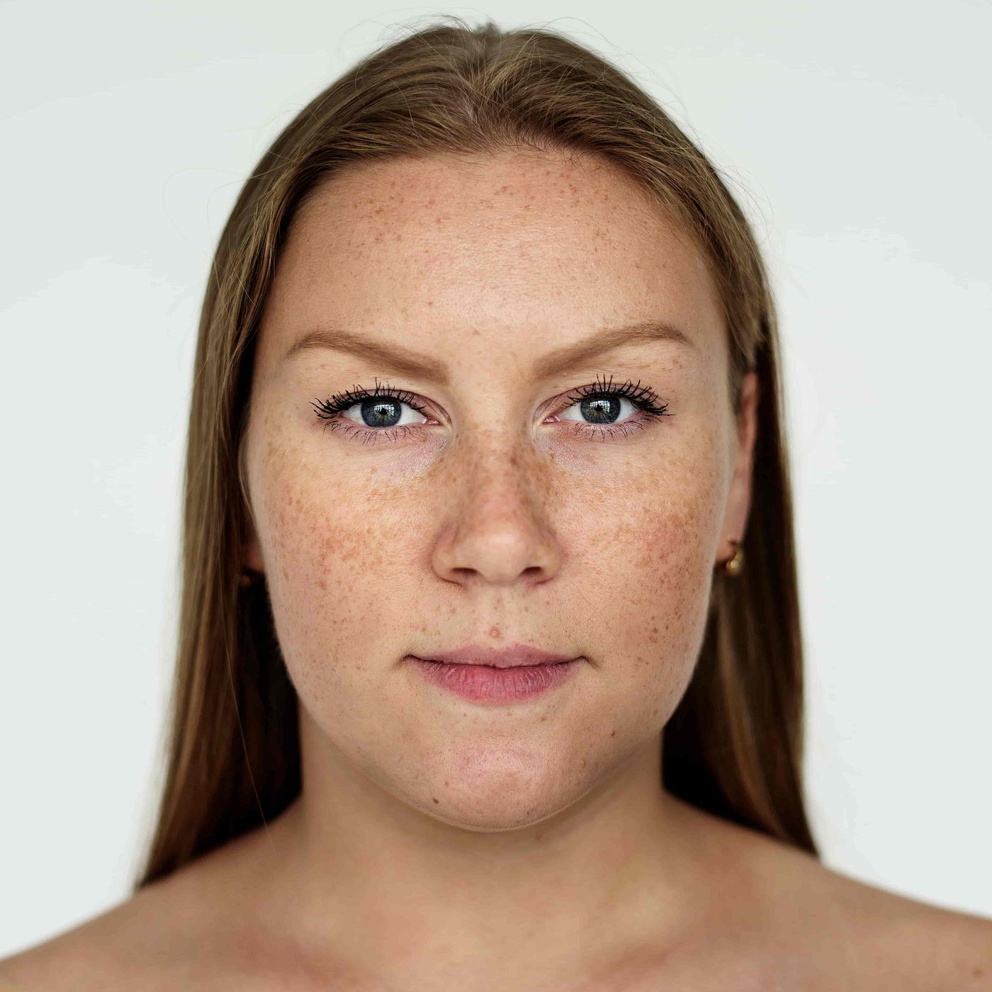 Clareadores para Melasma: o que realmente funciona (e por quê a maioria decepciona)