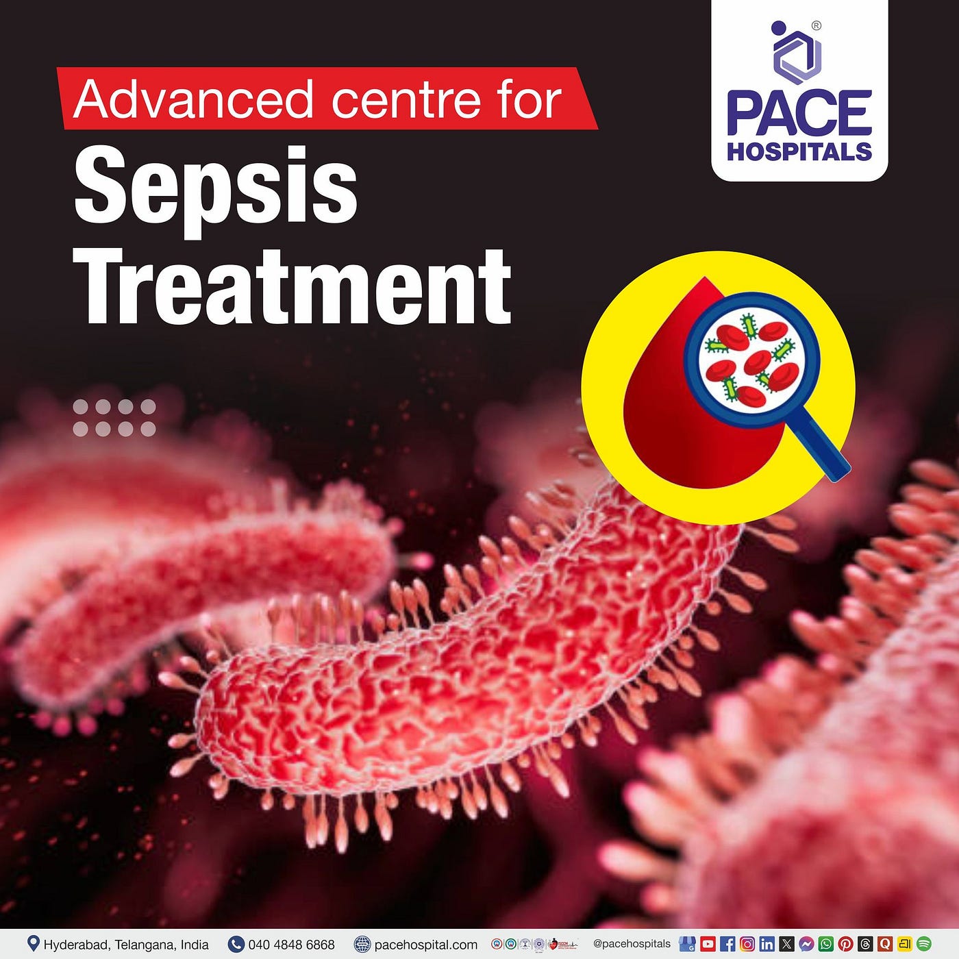 Sepsis Management: Understanding the Condition and Available Treatment Options