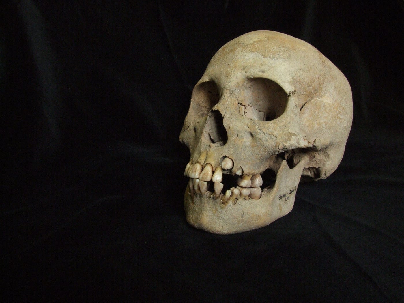 Plague Is Thousands of Years Older Than We Thought, And It Started in Siberia