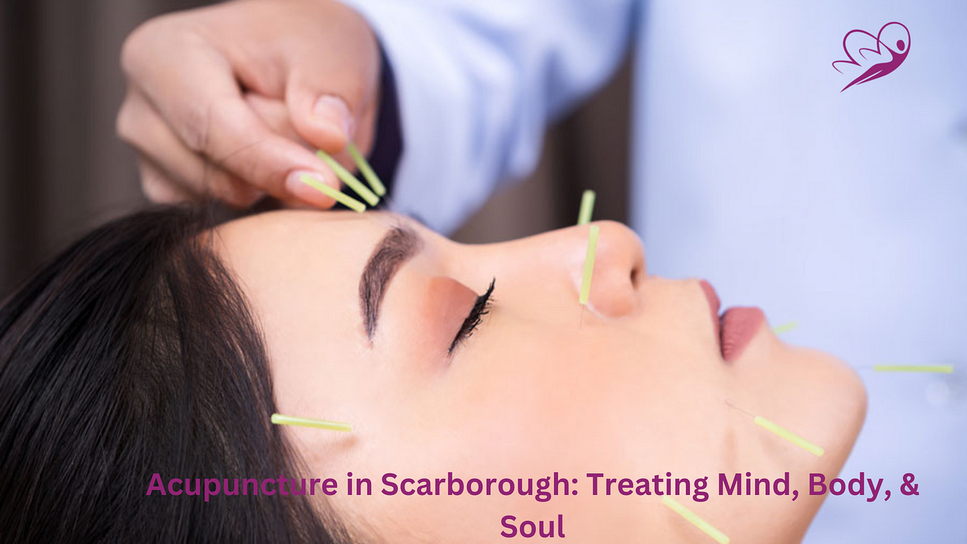 Acupuncture in Scarborough: Treating Mind, Body, & Soul