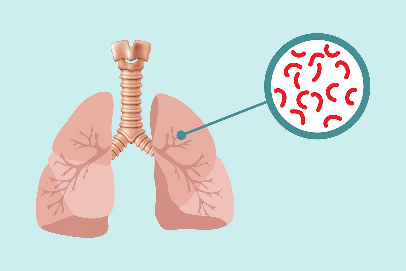 8 Risk Factors That Increase the Chances of Tuberculosis — Insights from the Best Pulmonologist in…