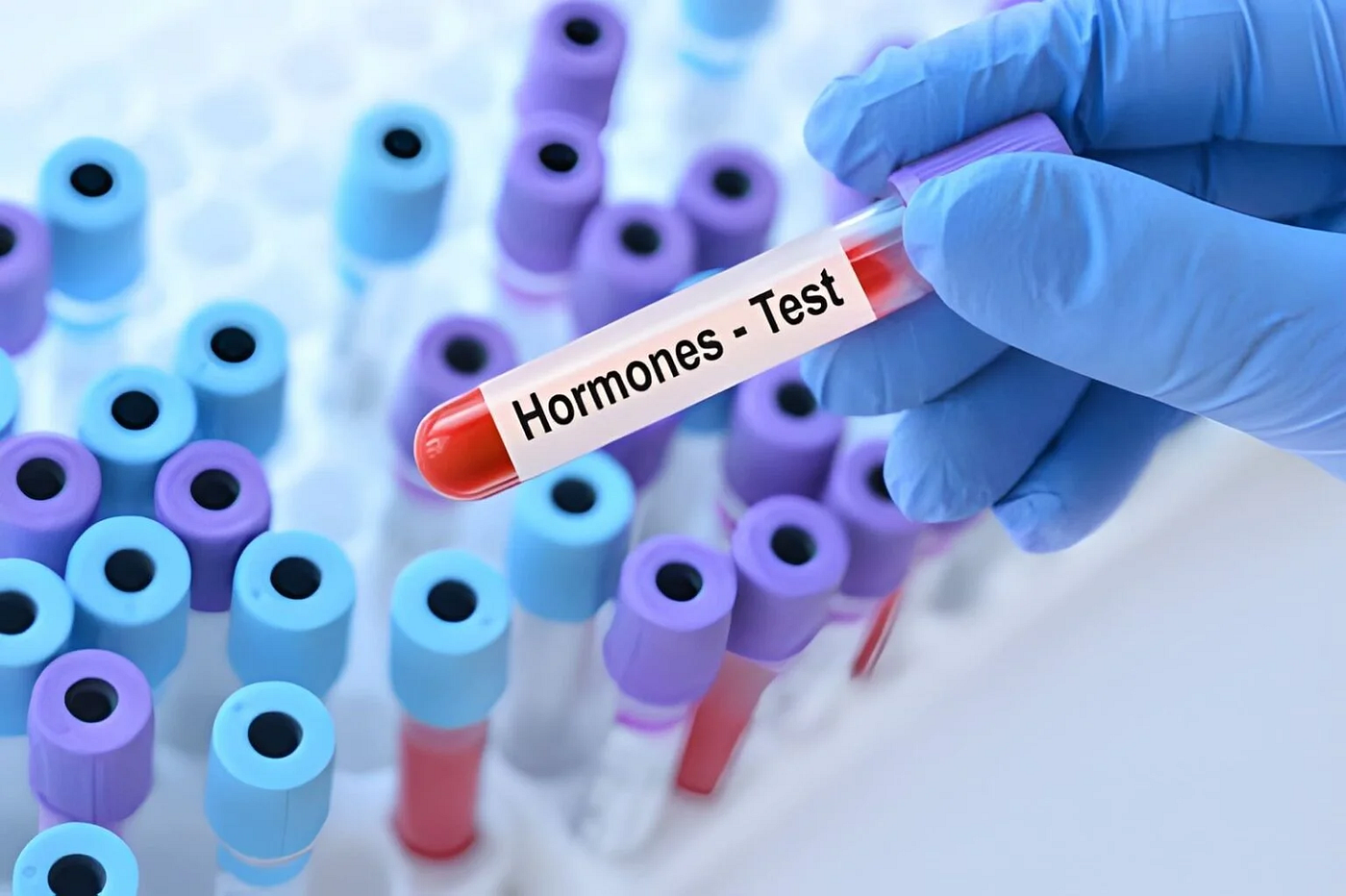 Hormon Testi Nedir? Hangi Belirtilerde Yapılmalı?