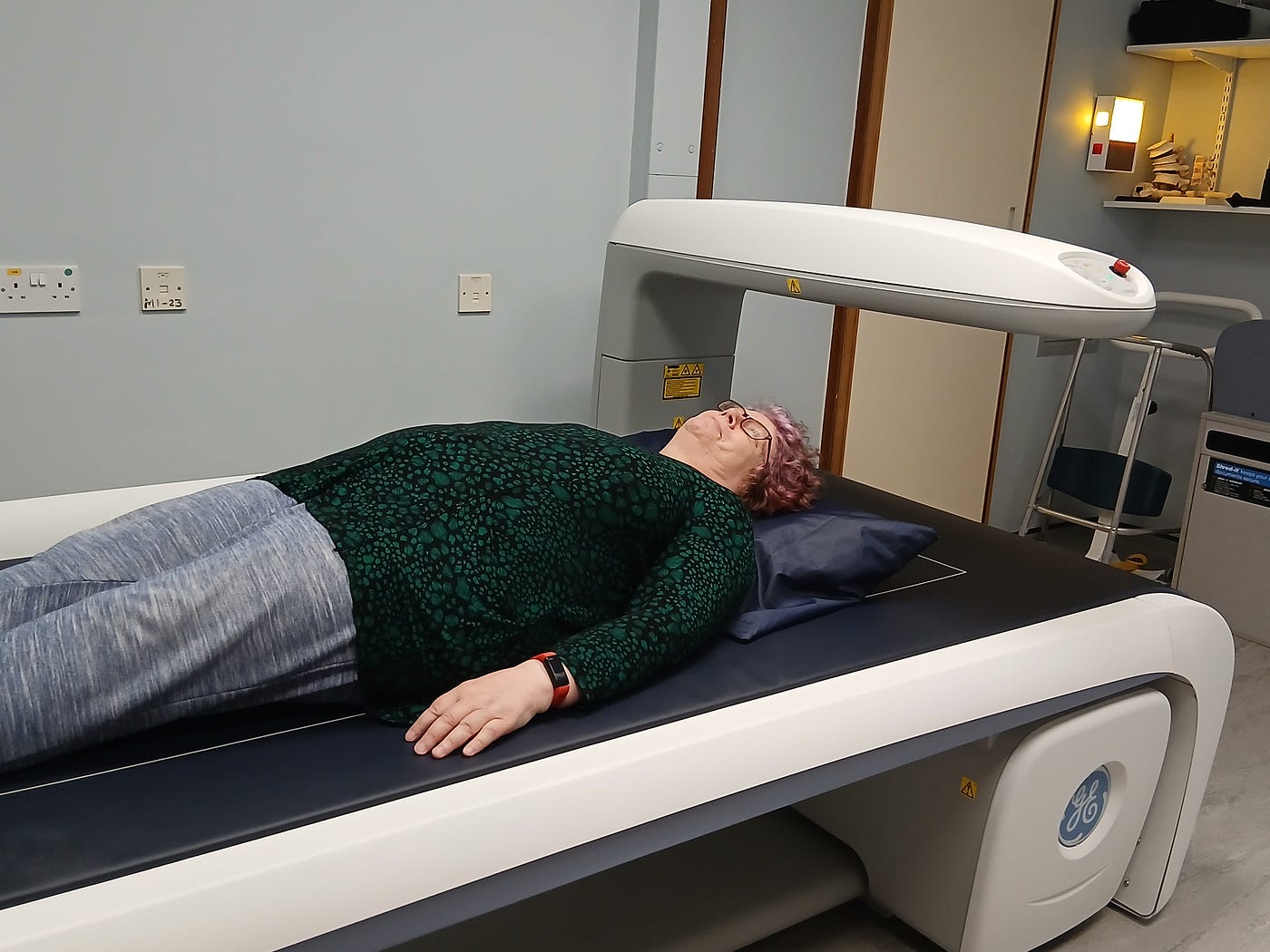 The “Silent” Side of Oestrogen Suppression: What It’s Really Like to Get a DEXA Scan